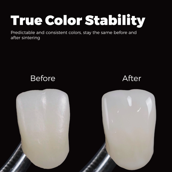 teeth staining